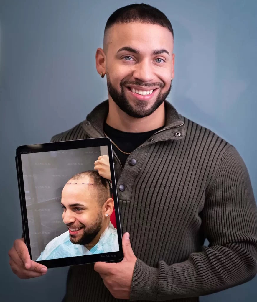 An image showing an FUE hair transplant patient holding an iPad with this own image before undergoing hair restoration