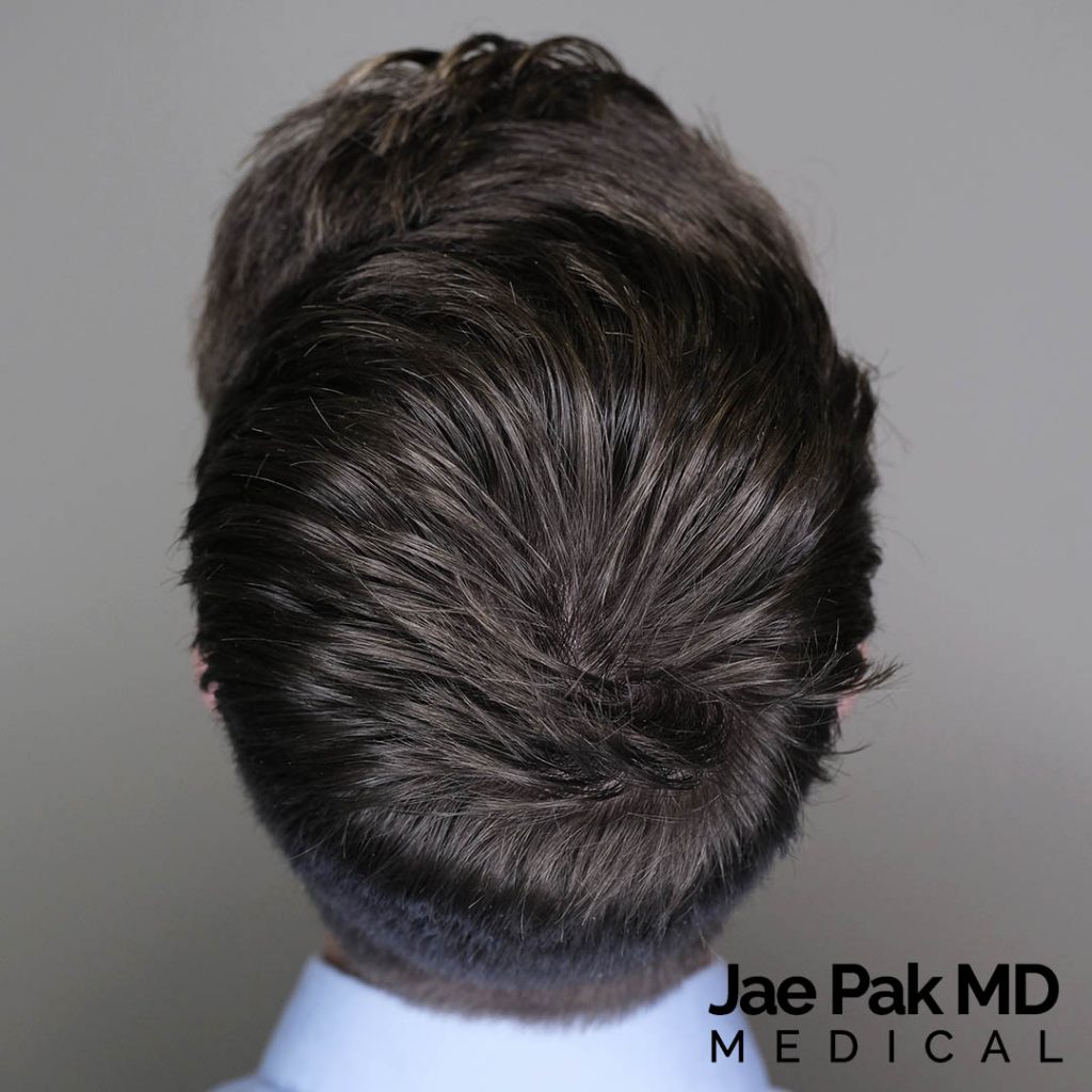 Actual Patient of Jae Pak, M.D