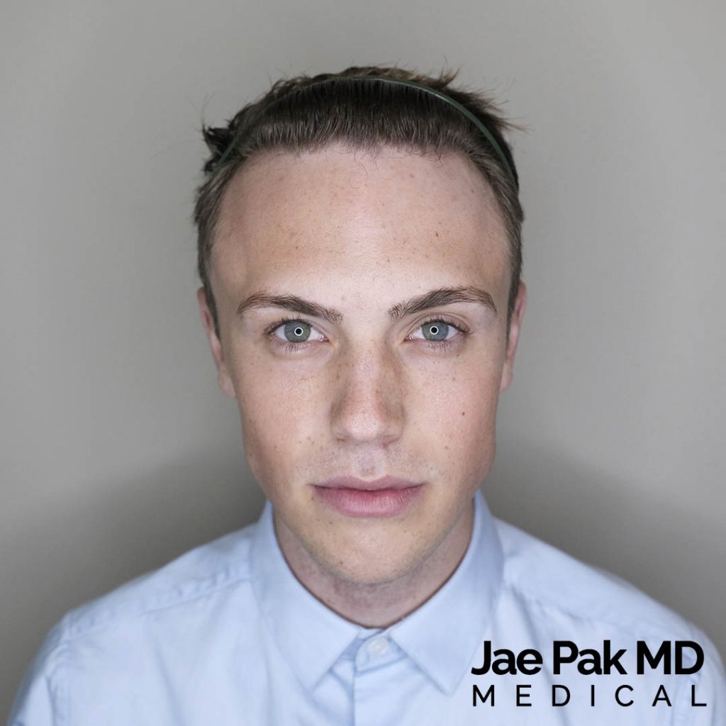 Actual Patient of Jae Pak, M.D