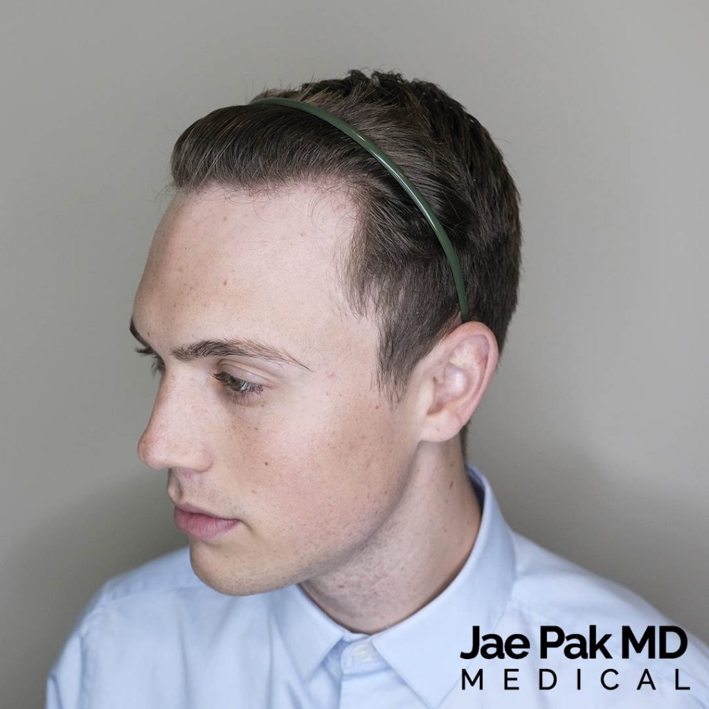 Actual Patient of Jae Pak, M.D