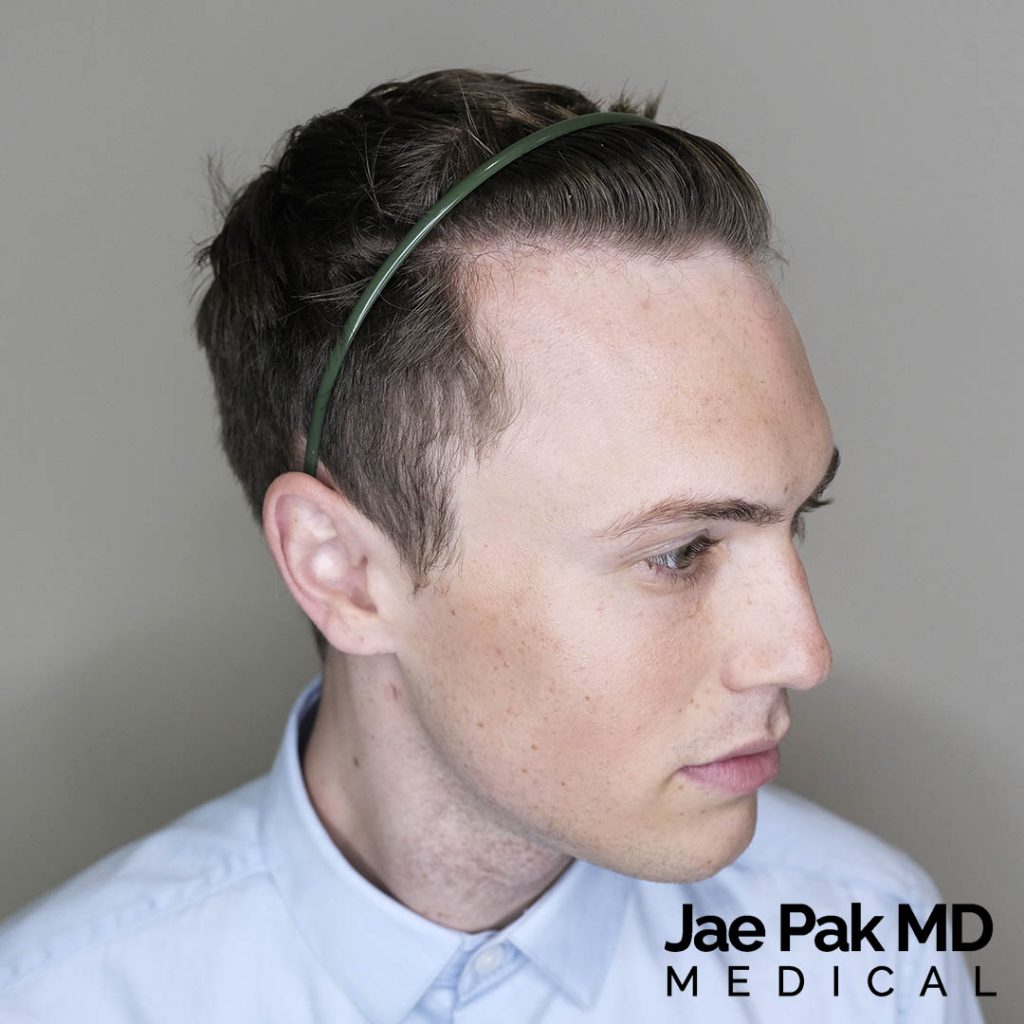 Actual Patient of Jae Pak, M.D