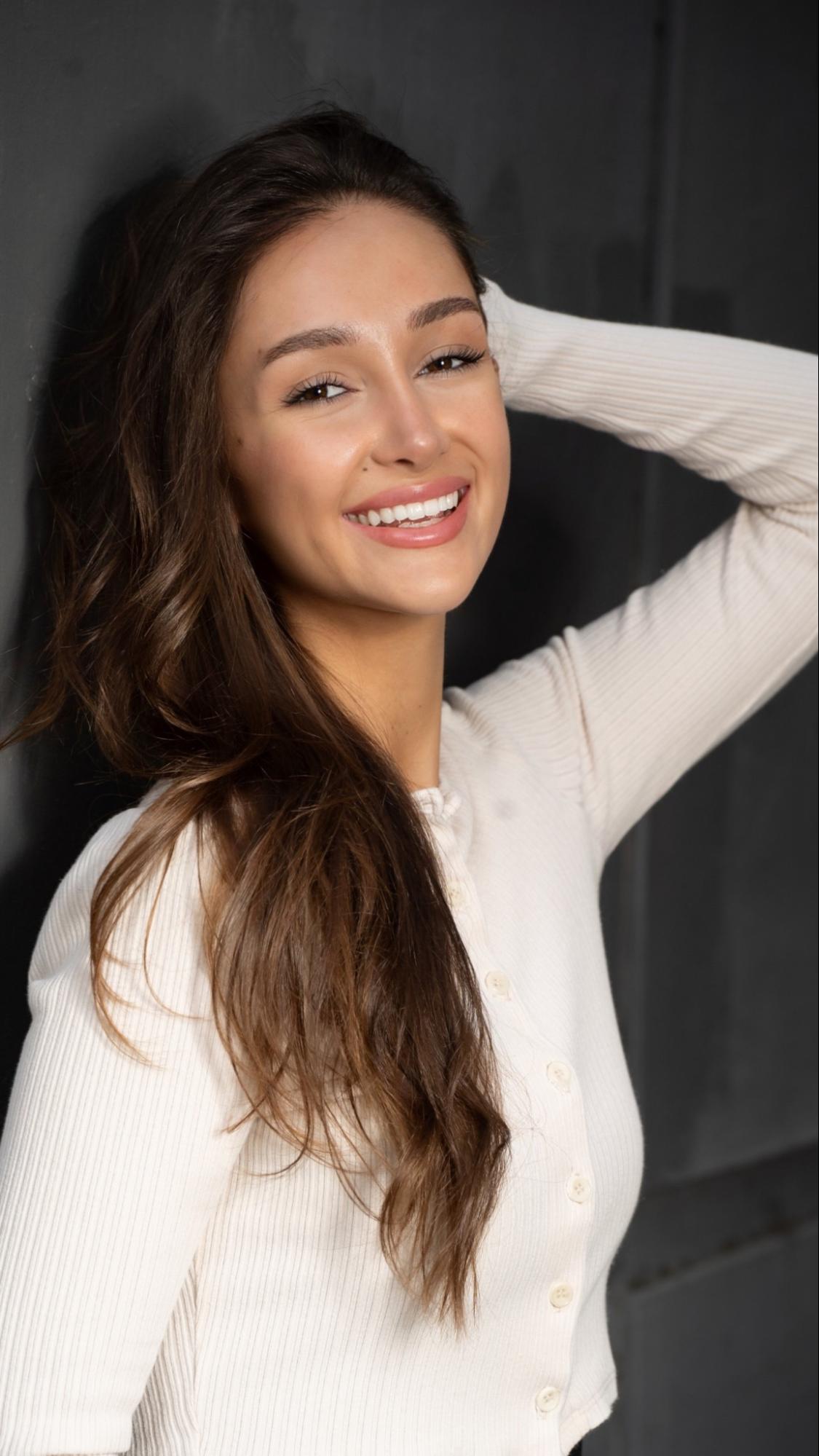 After FUT hairline lowering — an image showing a smiling female patient showing a natural, lowered hairline and balanced facial framing (1,420 grafts).