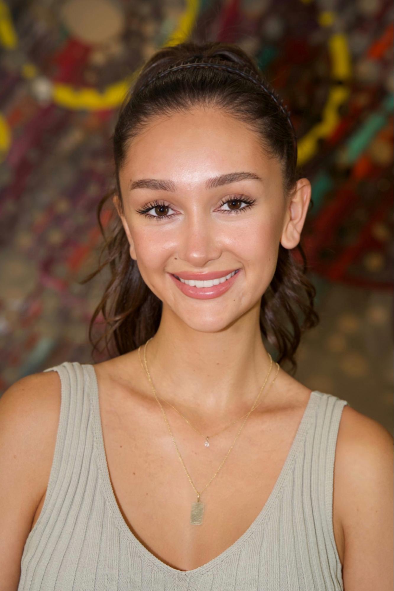 An image of Dr. Pak’s actual patient who underwent FUT hairline lowering. An internet personality shows her smile and her newly restored hairline.