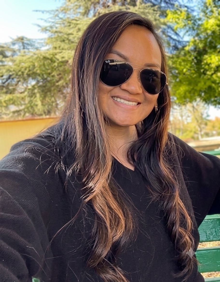 An image of Dr. Pak’s actual patient who underwent FUT hairline lowering. An internet personality shows her smile and her newly restored hairline.